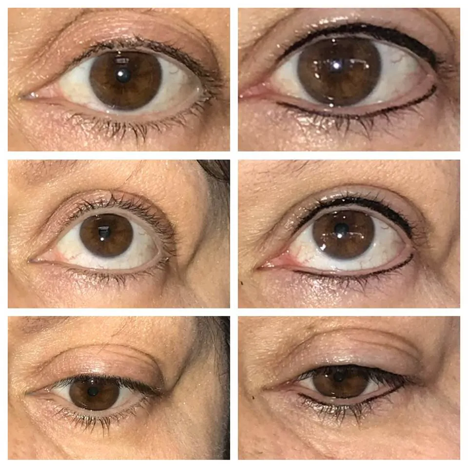 Permanent Eyeliner Before After 2
