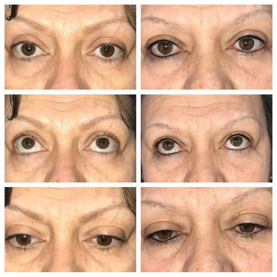 Lash Enhancement Before After Austin